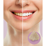 DEPURDENT Clean & Polish Whitning Mondwater