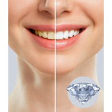 Emoform DIAMOND Whitening Tandpasta