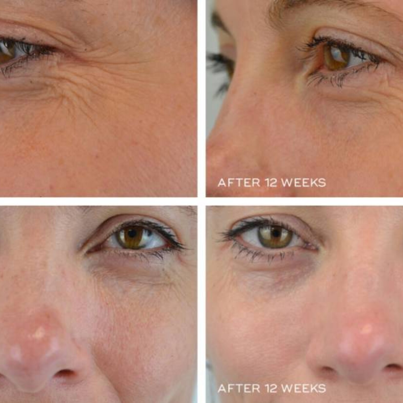 Medik8 Crystal Retinal 10