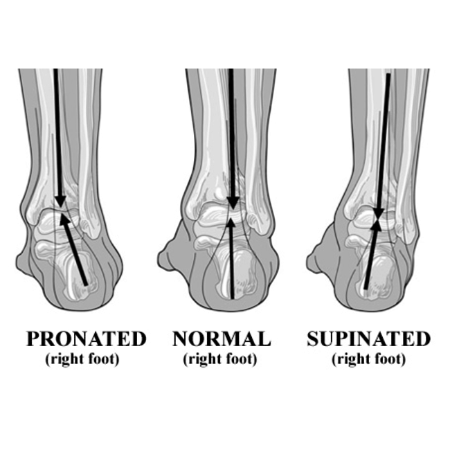 Regular 2" Chisholms met Leveler stijgbeugels