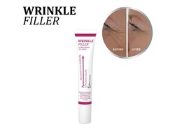 Wrinkle Filler