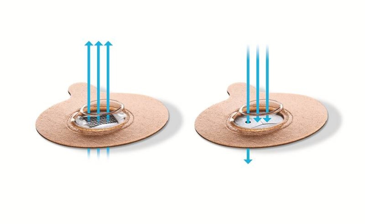 Provent Sleep Therapy Standard pack