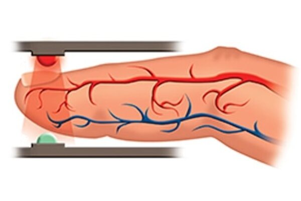 Nonin Onyx Vantage 9590 Oxymètre de pouls