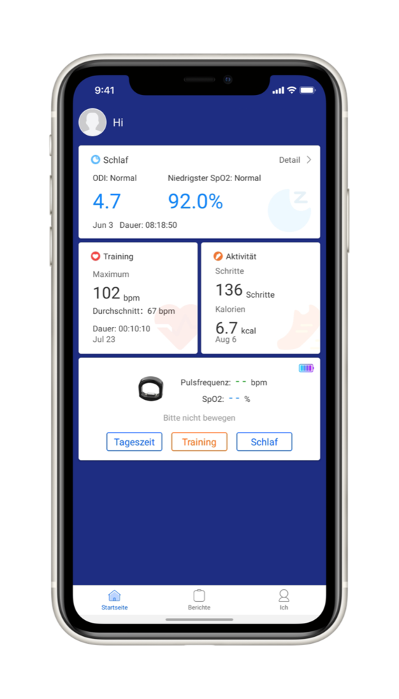 BodiMetrics CIRCUL Health Monitor Ring BodiMetrics CIRCUL Health Monitor Ring