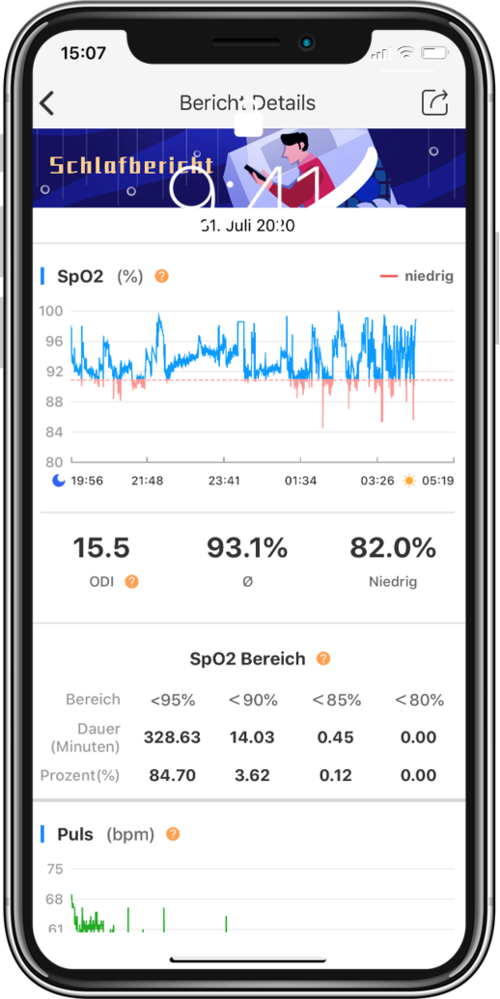 BodiMetrics CIRCUL Health Monitor Ring BodiMetrics CIRCUL Health Monitor Ring