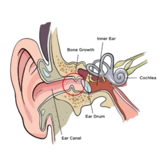 Surf Ears 4.0 : Coral Sky