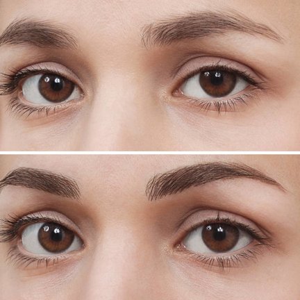 Wimperserum