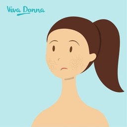 Hoe verzorg je een droge huid ? - Viva Donna