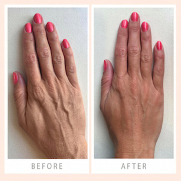 Wrinkle Schminkles Hand-Smoothing-Set – Anti-Falten-Pads für die Hände