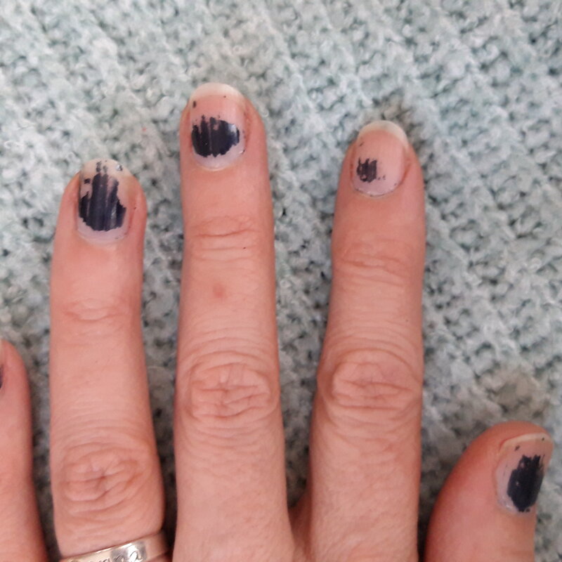 Nooit meer lelijk afgebladderde nagellak met Striplac