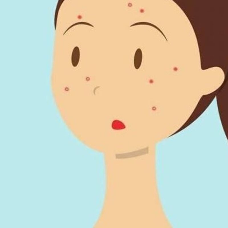 Als een puist niet doorkomt, wat doe je dan?