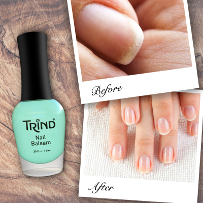 Droge nagels? Zo voorkom je ze!