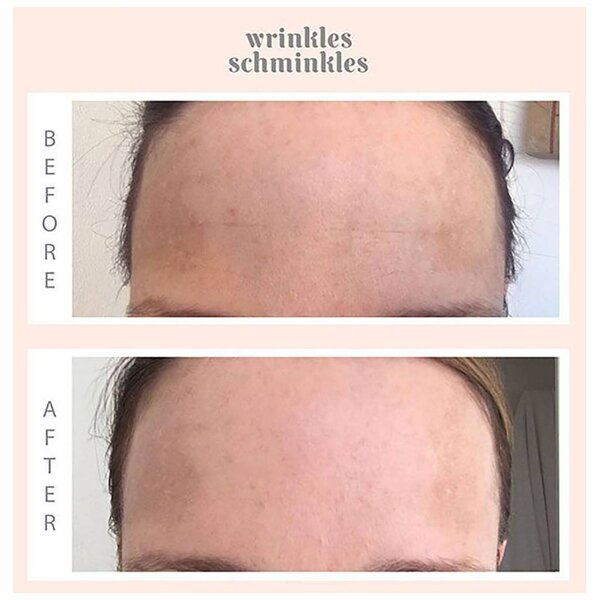 Wrinkle Schminkles Forehead Smooting Kit - anti rimpel pads voor het voorhoofd 1st