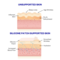 Wrinkle Schminkles Forehead Smooting Kit - anti rimpel pads voor het voorhoofd 1st