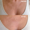 Wrinkle Schminkles Chest & Decolletage Smoothing Kit 1 st