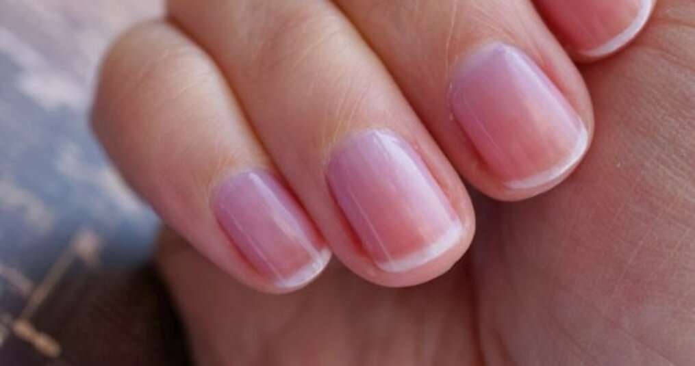 Wat te doen tegen verkleuring van de nagels door Striplac of nagellak?