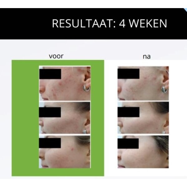 Ann Kathy Clear Skin Wash – milde Gesichtsreinigung für unreine, zu Akne neigende Haut