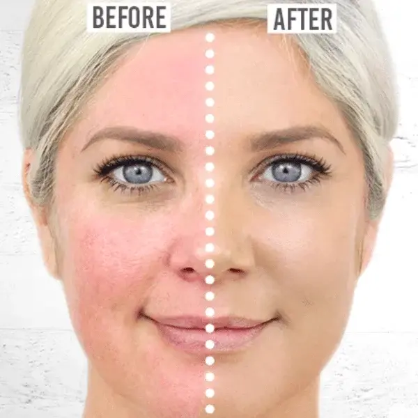 Rosalique 3 in 1 Anti-Redness Miracle Formula SPF50 - vermindert roodheid bij rosacea en couperose