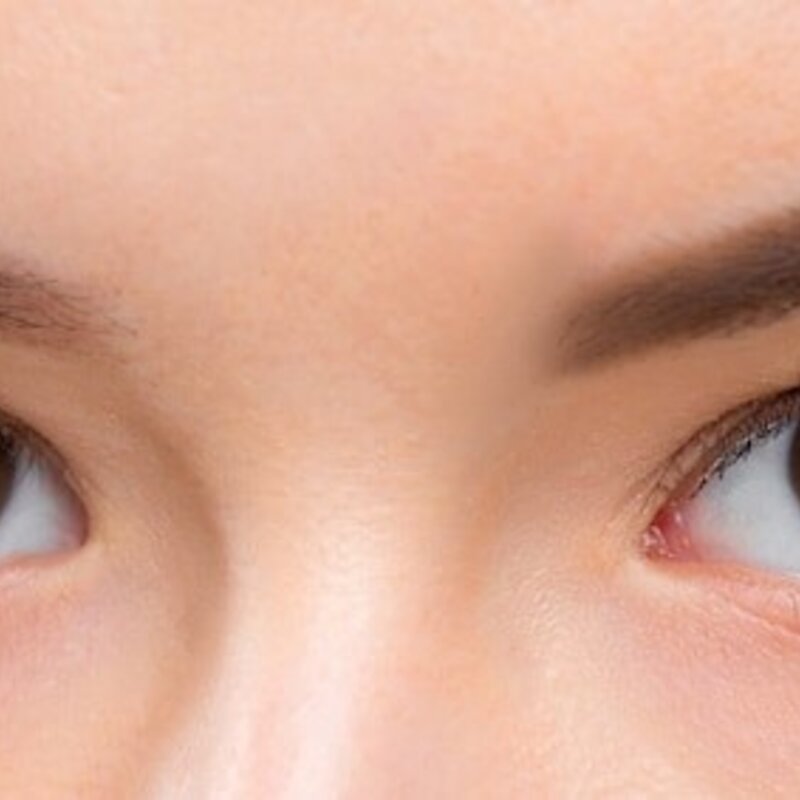 Overweeg je een ooglidcorrectie? Dit moet je weten.