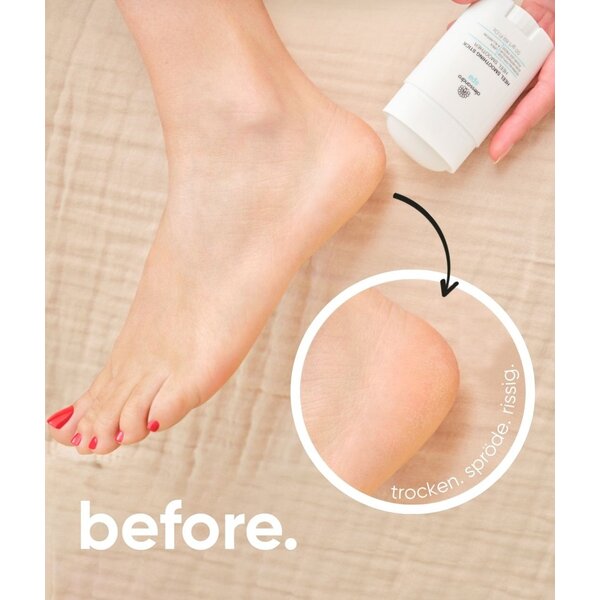 Alessandro Foot Spa Heel Smooting Stick voor droge eeltplekken 50gr