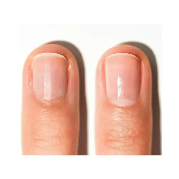 Alessandro Spa Nail Cuticle remover - nagelriem verwijderaar 10ml
