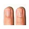 Alessandro Spa Nail Cuticle remover - nagelriem verwijderaar 10ml