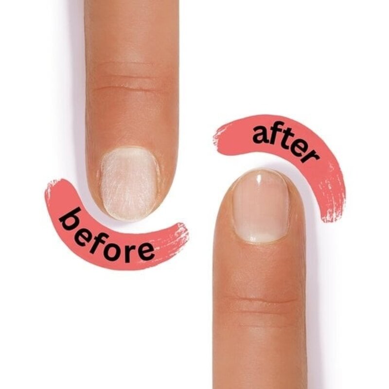 Alessandro SOS Nail Repair: Redder in nood voor zwakke en beschadigde nagels
