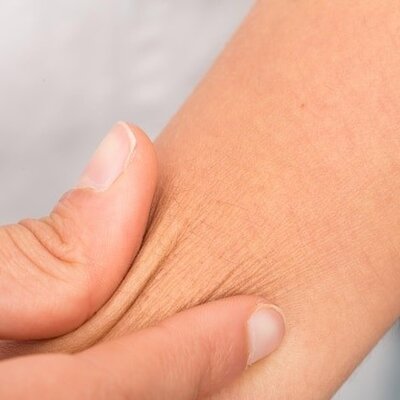 Hoe ontstaat een droge huid en wat doe je er tegen?