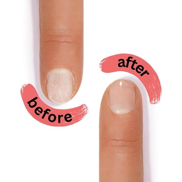Alessandro SOS nail Clinic repair & care - herstellende set voor nagels die droog zijn en gemakkelijk breken - voedend - herstellend - werkt echt!