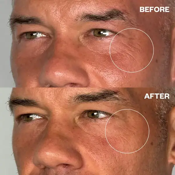 Wrinkle Schminkles For Men eyes 1 paar