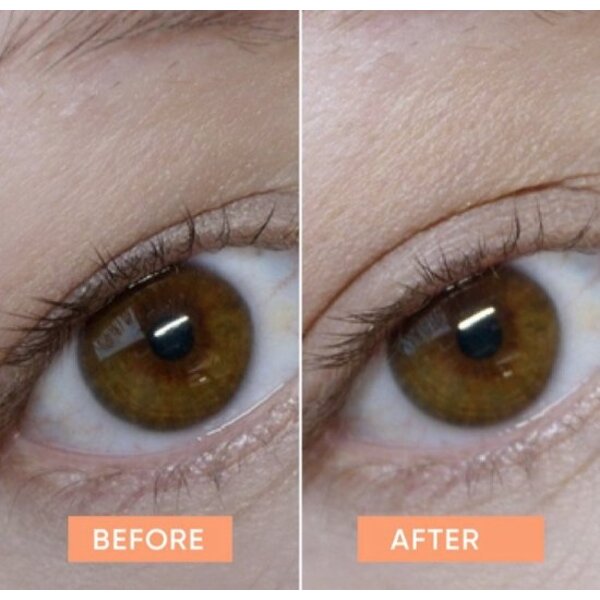 Apricot Beauty Eyelid Lifting Tapes 96 st
