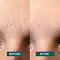 Apricot Beauty Face Patches Hyaluron 100st