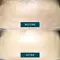 Apricot Beauty Forehead Pad Hexapeptide Technology 30st
