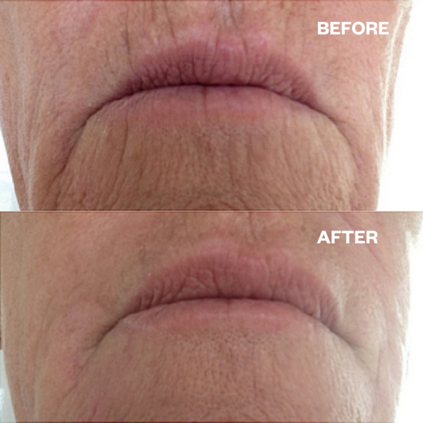 Wrinkle Schminkles Deep Mouth set
