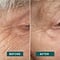 Apricot Beauty Apricot Beauty Eyelpads Hyaluron - hydraterend - anti-rimpel pads voor onder je ogen  - tegen rimpels