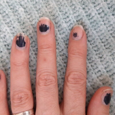 Mit Striplac gehört hässlich abblätternder Nagellack der Vergangenheit an