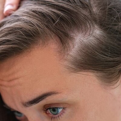 Leiden Sie unter Haarausfall? Diese Tipps können helfen!