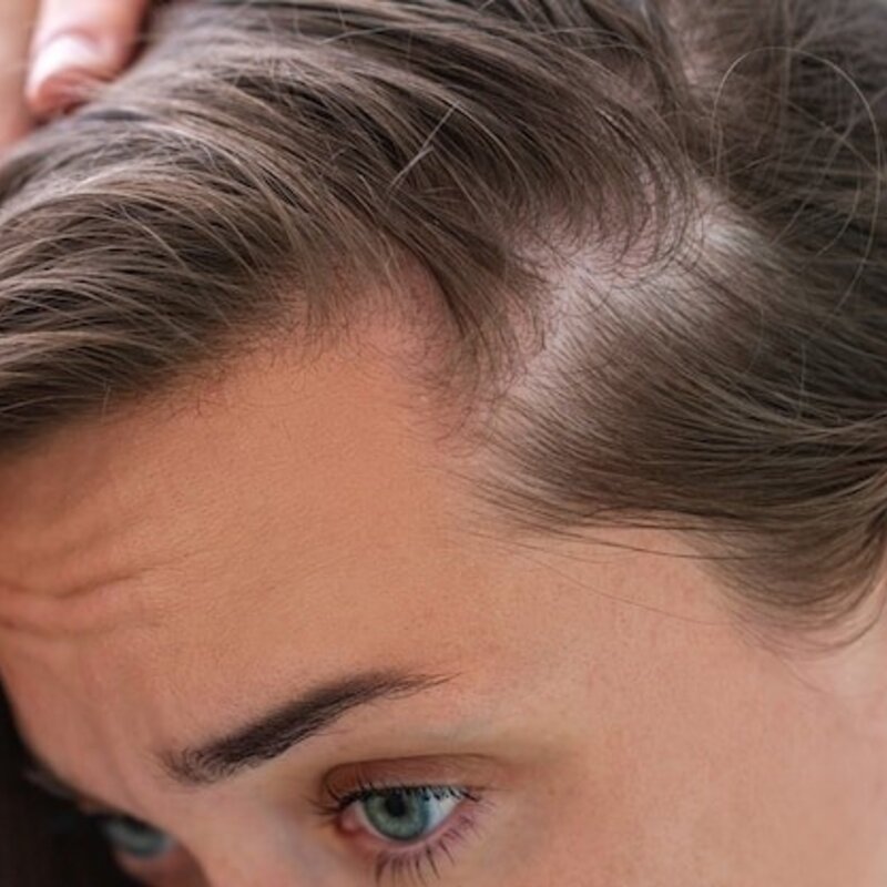 Leiden Sie unter Haarausfall? Diese Tipps können helfen!