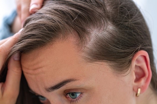 Leiden Sie unter Haarausfall? Diese Tipps können helfen!
