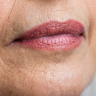Wie beugt man Falten und Fältchen auf und um die Lippen herum vor und wie behandelt man sie?