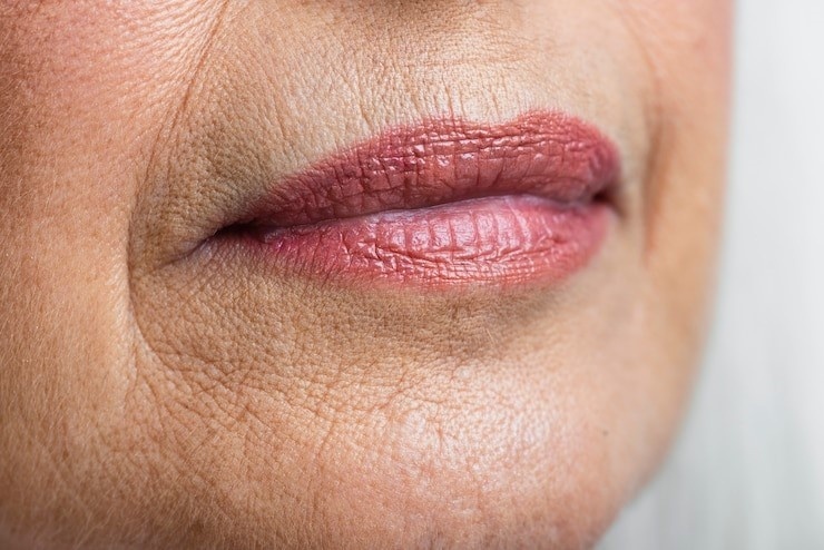 Wie beugt man Falten und Fältchen auf und um die Lippen herum vor und wie behandelt man sie?