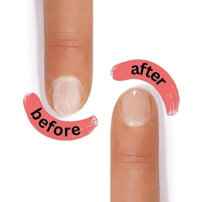 Alessandro SOS Nail Repair: Der Retter in der Not für schwache und geschädigte Nägel