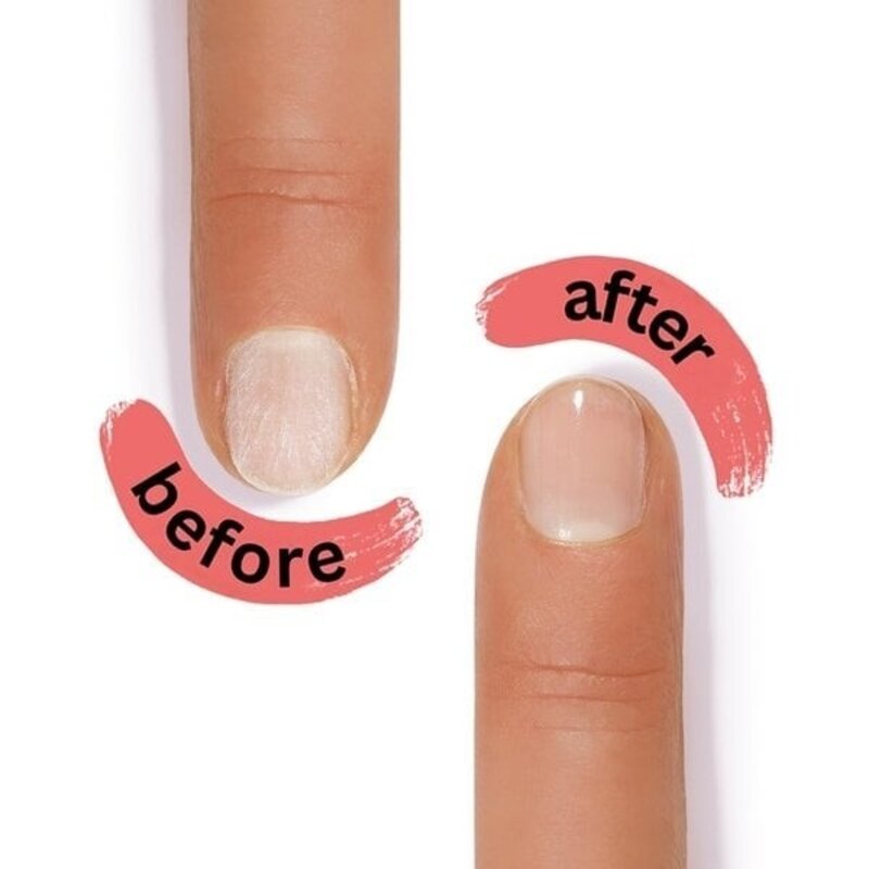 Alessandro SOS Nail Repair: Der Retter in der Not für schwache und geschädigte Nägel