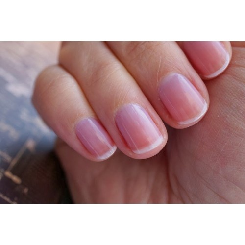 Was kann man gegen Verfärbungen der Nägel durch Striplac oder Nagellack tun?
