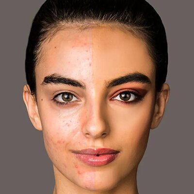 Make-up-Tipps für dein Hautproblem