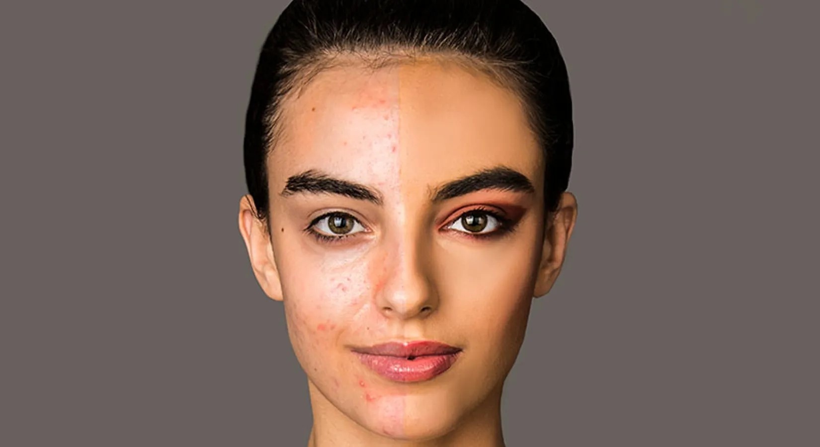 Make-up-Tipps für dein Hautproblem