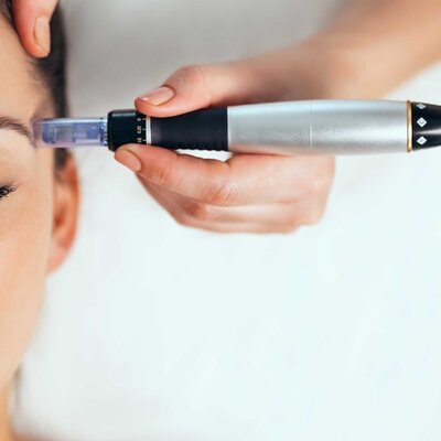 Microneedling; Alles, was Sie wissen müssen, bevor Sie beginnen!