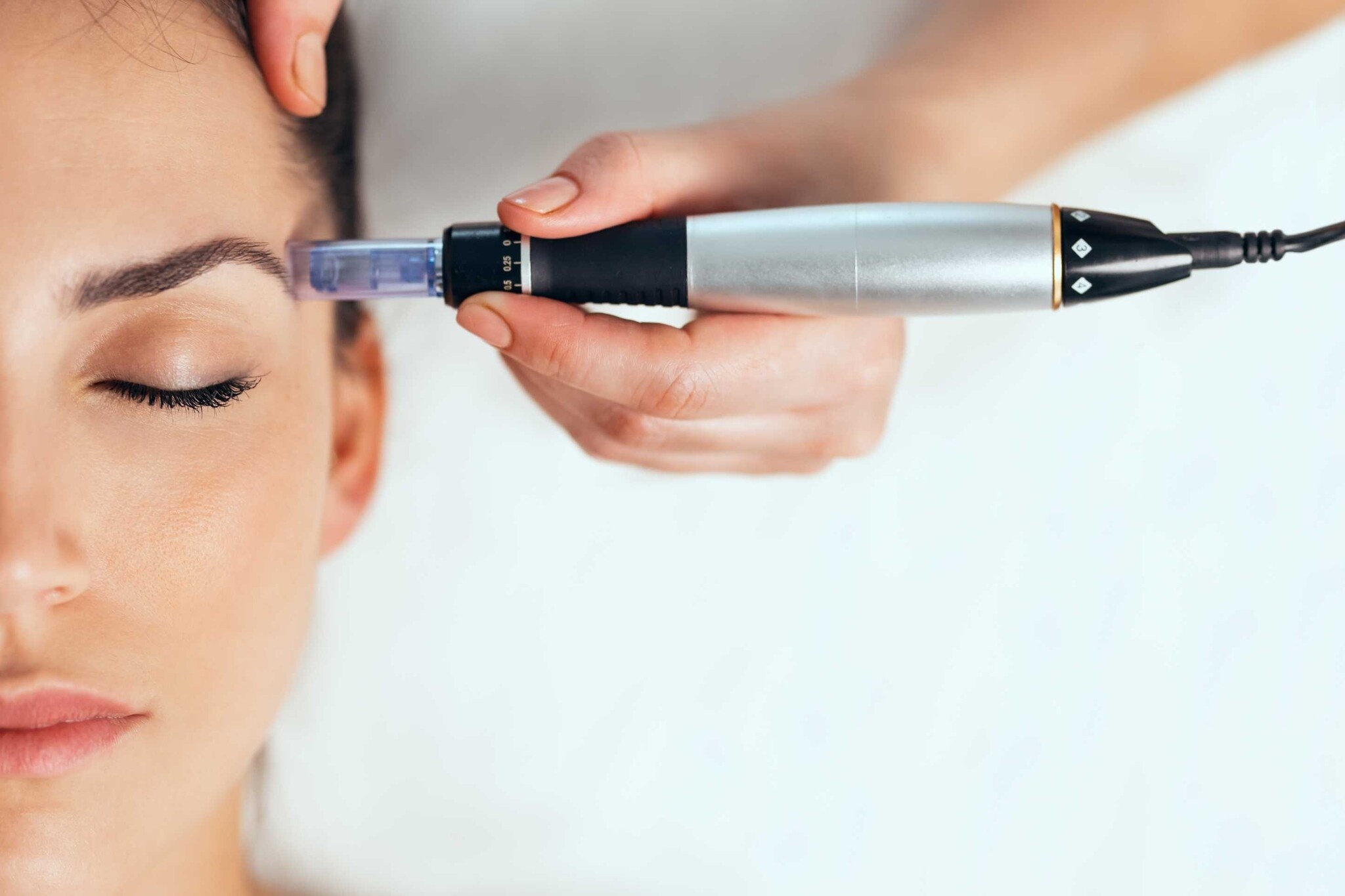 Microneedling; Alles, was Sie wissen müssen, bevor Sie beginnen!