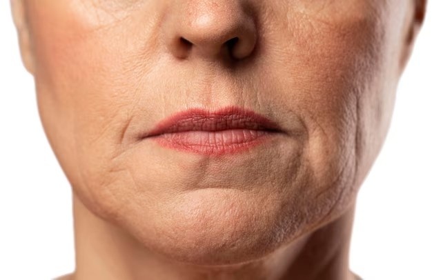 Tips tegen rimpels bij een droge huid 