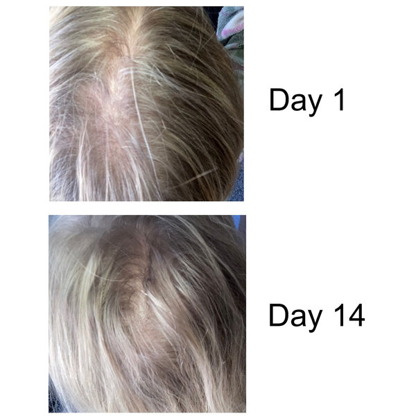 Kerabelle Hair Capsules - tegen haaruitval en vermindering van haaruitval.